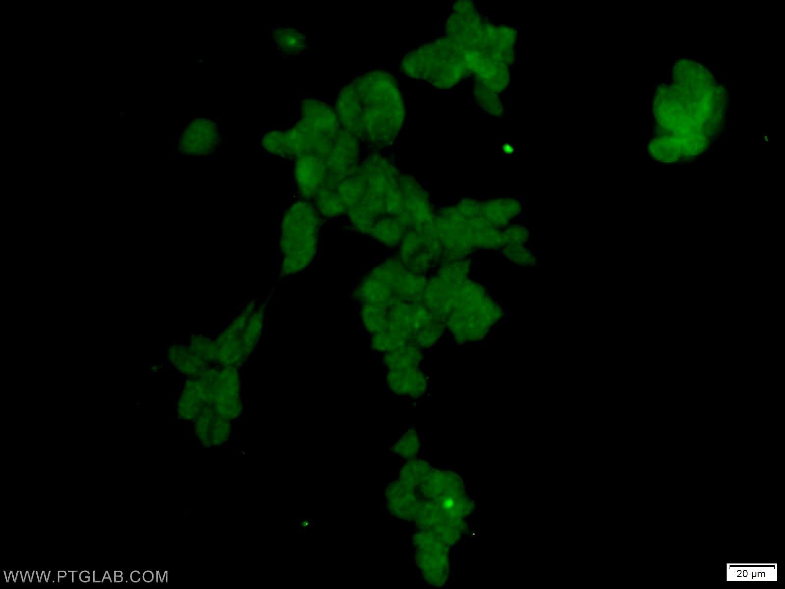 Immunofluorescence (IF) / fluorescent staining of HEK-293 cells using SCML2 Polyclonal antibody (25544-1-AP)