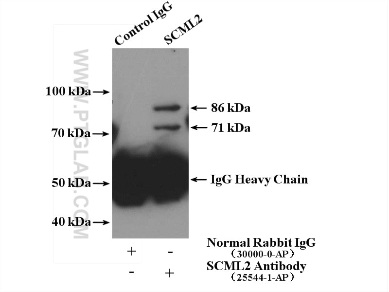 Immunoprecipitation (IP) experiment of HEK-293 cells using SCML2 Polyclonal antibody (25544-1-AP)