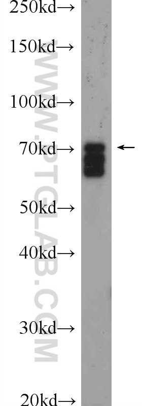 Western Blot (WB) analysis of mouse testis tissue using SCML2 Polyclonal antibody (25544-1-AP)