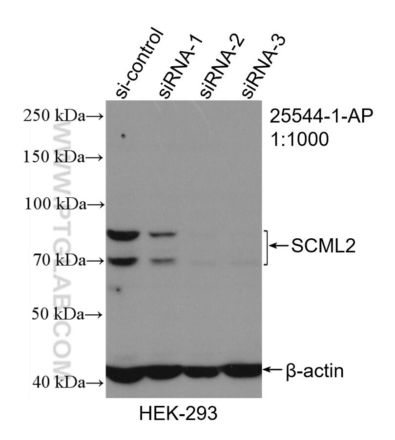 Western Blot (WB) analysis of HEK-293 cells using SCML2 Polyclonal antibody (25544-1-AP)