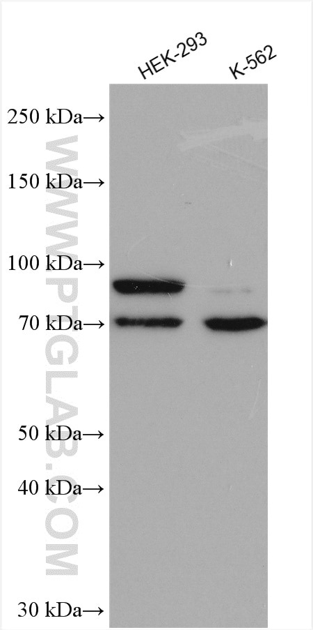 Western Blot (WB) analysis of various lysates using SCML2 Polyclonal antibody (25544-1-AP)