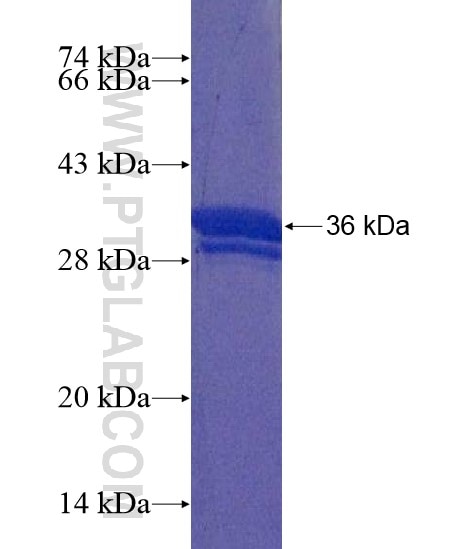 SCML2 fusion protein Ag22271 SDS-PAGE