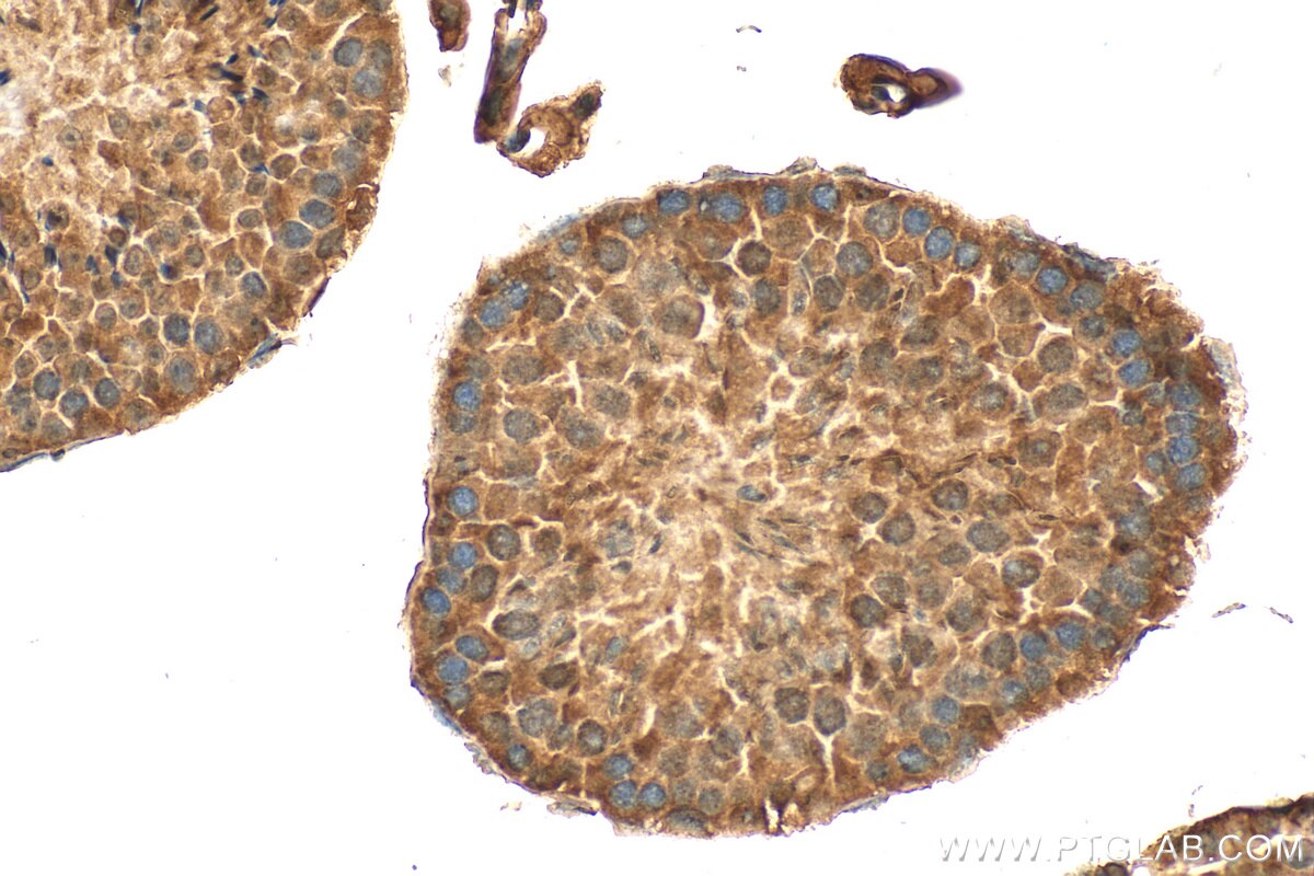 Immunohistochemical analysis of paraffin-embedded mouse testis tissue slide using 25439-1-AP (SCML4 antibody) at dilution of 1:100 (under 40x lens). Heat mediated antigen retrieval with Tris-EDTA buffer (pH 9.0). Immunohistochemistry (IHC) staining of mouse testis tissue using SCML4 Polyclonal antibody (25439-1-AP)