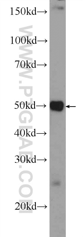 Western Blot (WB) analysis of mouse liver tissue using SCML4 Polyclonal antibody (25439-1-AP)