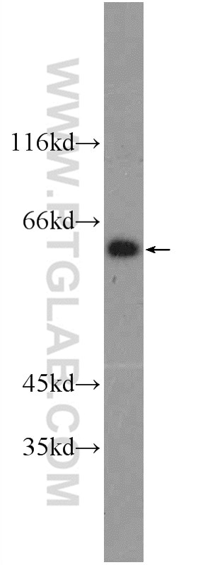 Western Blot (WB) analysis of A375 cells using SCML4 Polyclonal antibody (25439-1-AP)