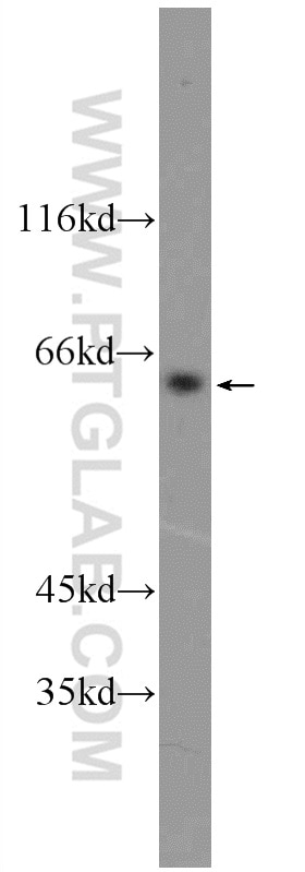 Western Blot (WB) analysis of HEK-293 cells using SCML4 Polyclonal antibody (25439-1-AP)