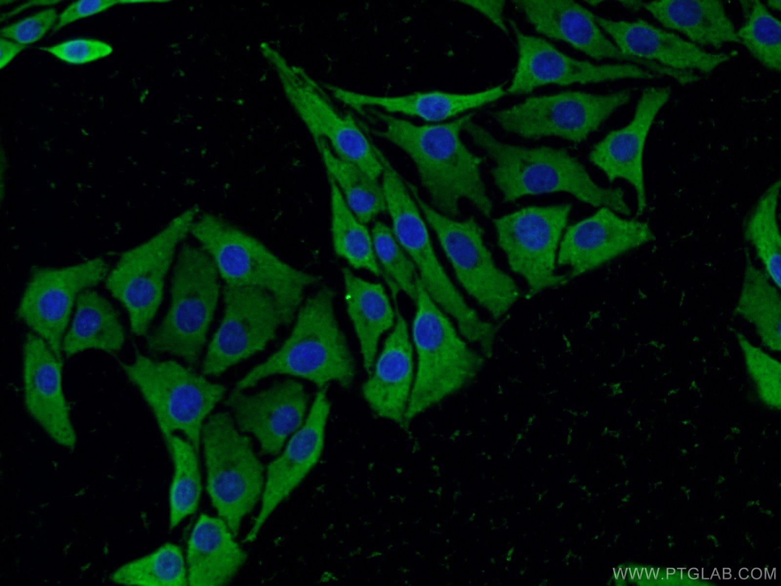 Immunofluorescence (IF) / fluorescent staining of SH-SY5Y cells using SCN10A Polyclonal antibody (55334-1-AP)