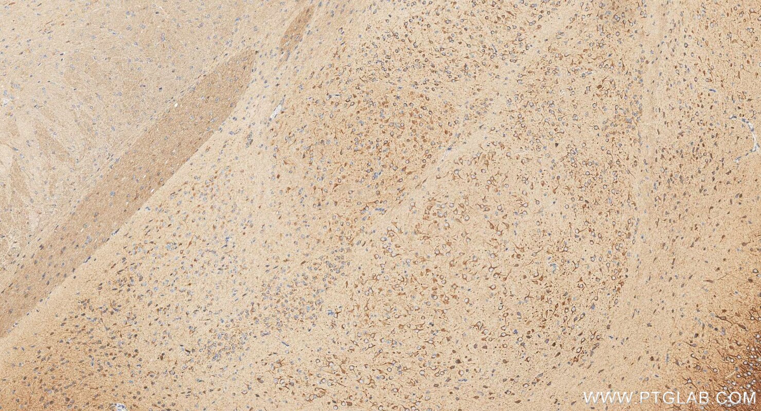 Immunohistochemistry (IHC) staining of mouse brain tissue using SCN10A Polyclonal antibody (55334-1-AP)