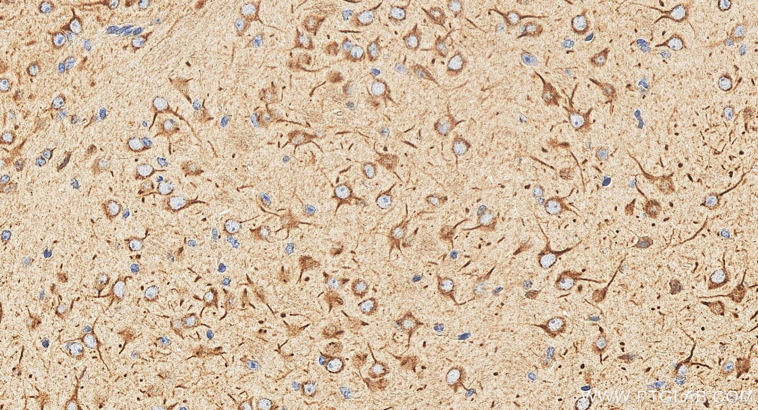 Immunohistochemistry (IHC) staining of mouse brain tissue using SCN10A Polyclonal antibody (55334-1-AP)