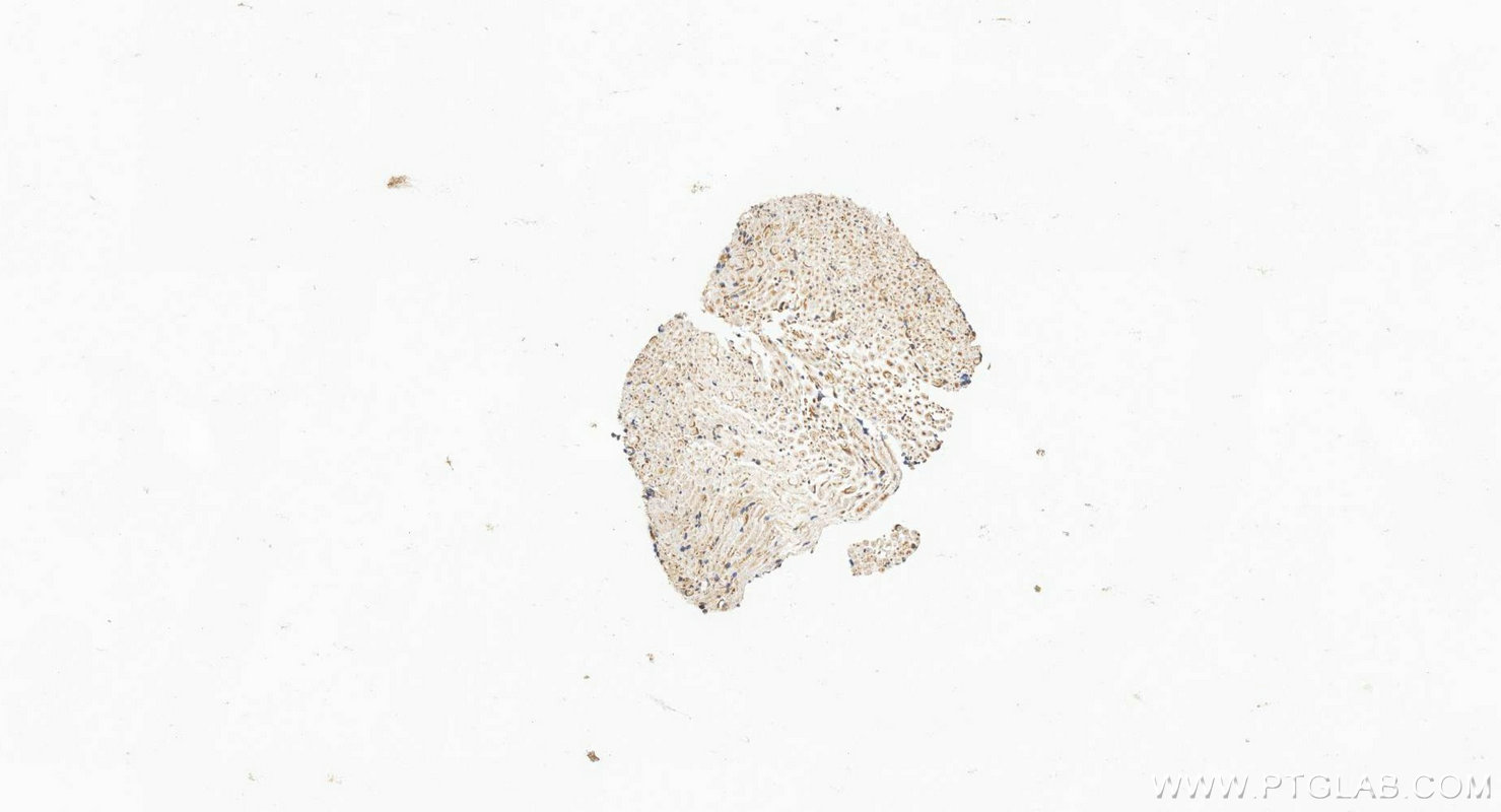Immunohistochemistry (IHC) staining of rat dorsal root ganglion tissue using SCN10A Polyclonal antibody (55334-1-AP)