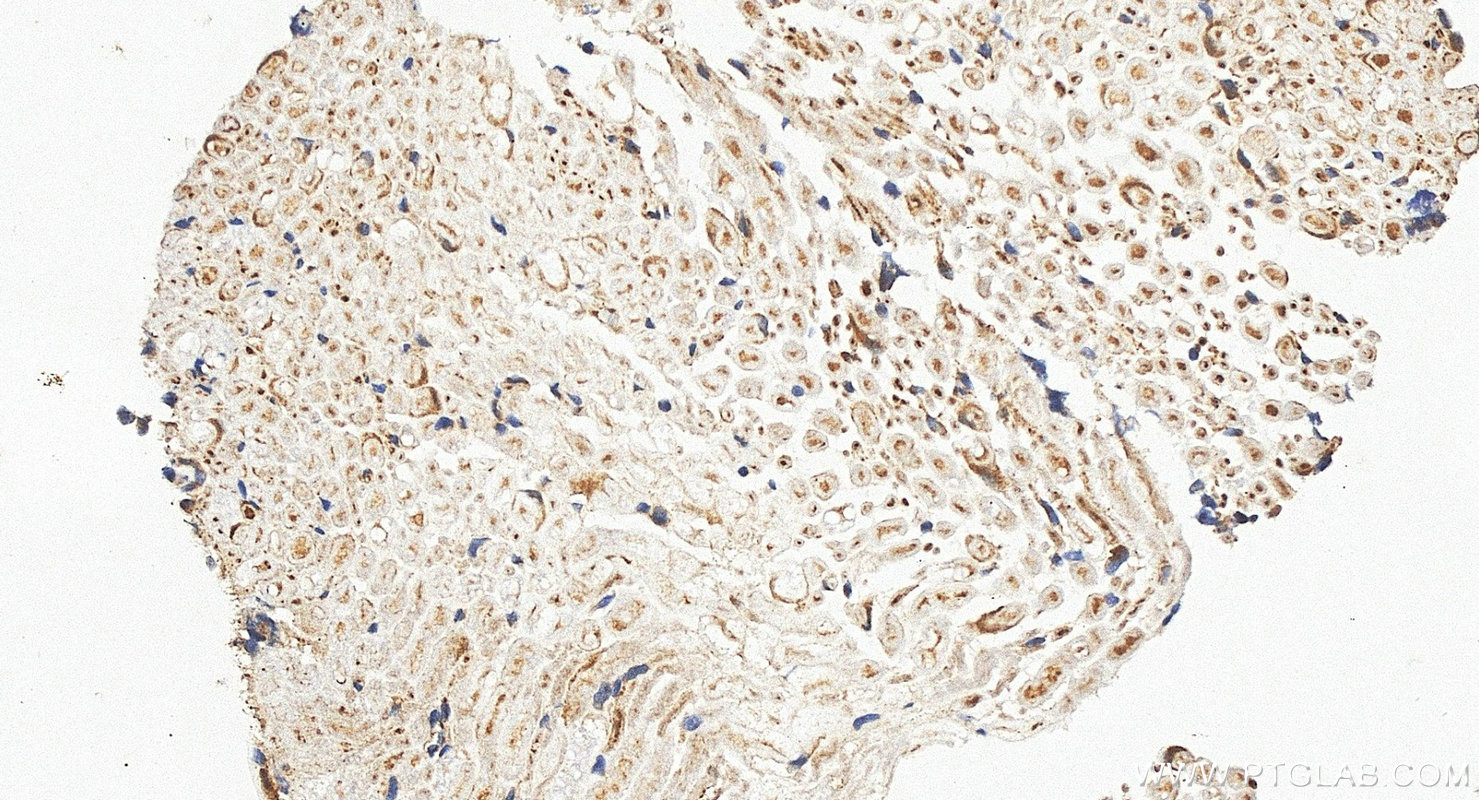 Immunohistochemistry (IHC) staining of rat dorsal root ganglion tissue using SCN10A Polyclonal antibody (55334-1-AP)