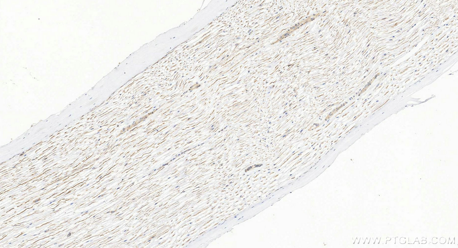 IHC staining of rat Ischiadic nerve using 55334-1-AP (same clone as 55334-1-PBS) Immunohistochemistry (IHC) staining of rat Ischiadic nerve tissue using SCN10A/Nav1.8 Polyclonal antibody (55334-1-AP)