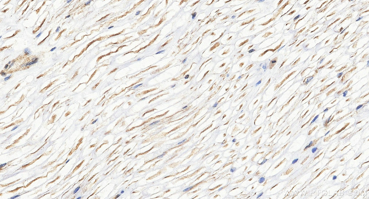 IHC staining of rat Ischiadic nerve using 55334-1-AP (same clone as 55334-1-PBS) Immunohistochemistry (IHC) staining of rat Ischiadic nerve tissue using SCN10A/Nav1.8 Polyclonal antibody (55334-1-AP)