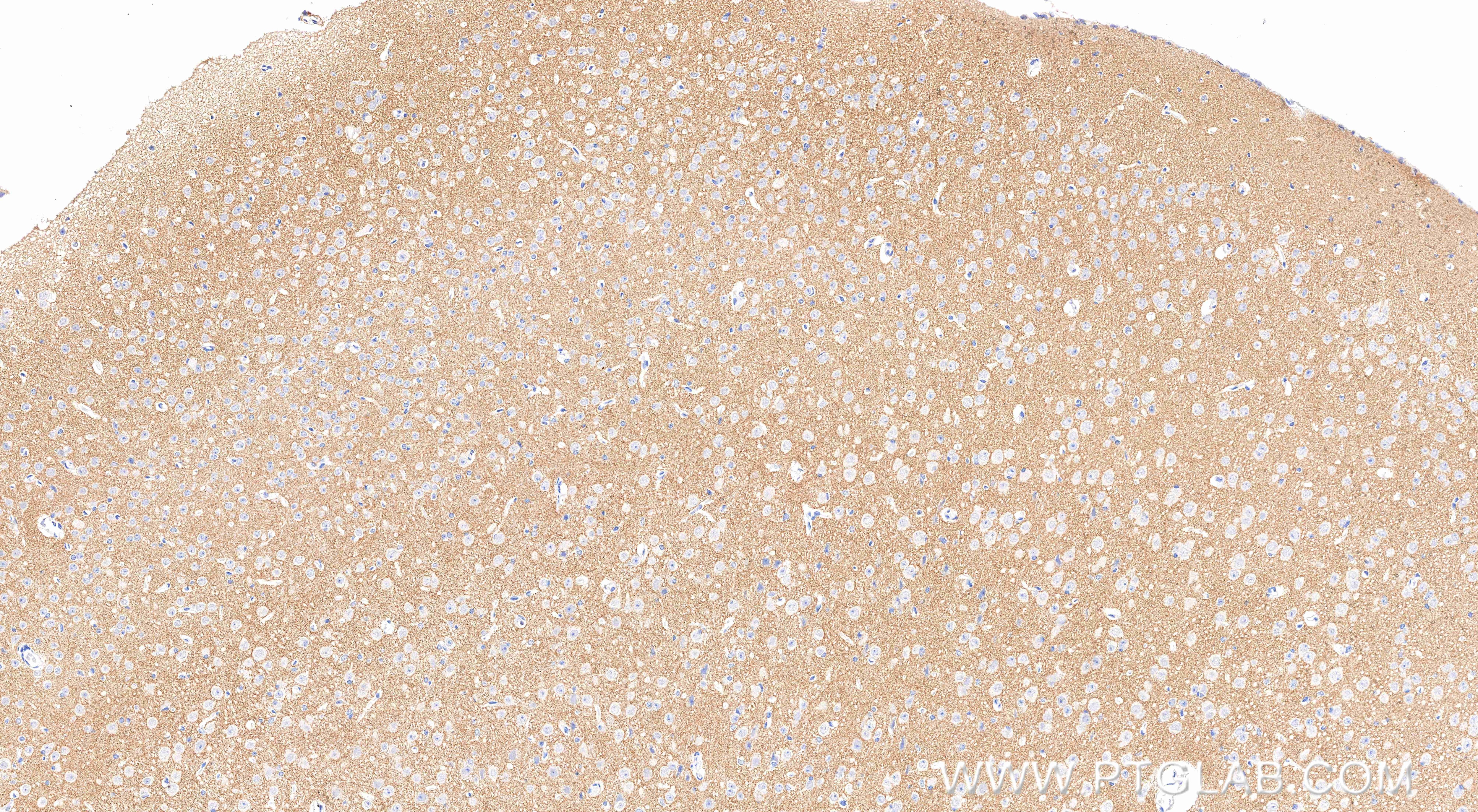 Immunohistochemistry (IHC) staining of mouse brain tissue using SCN11A Recombinant monoclonal antibody (85740-1-RR)