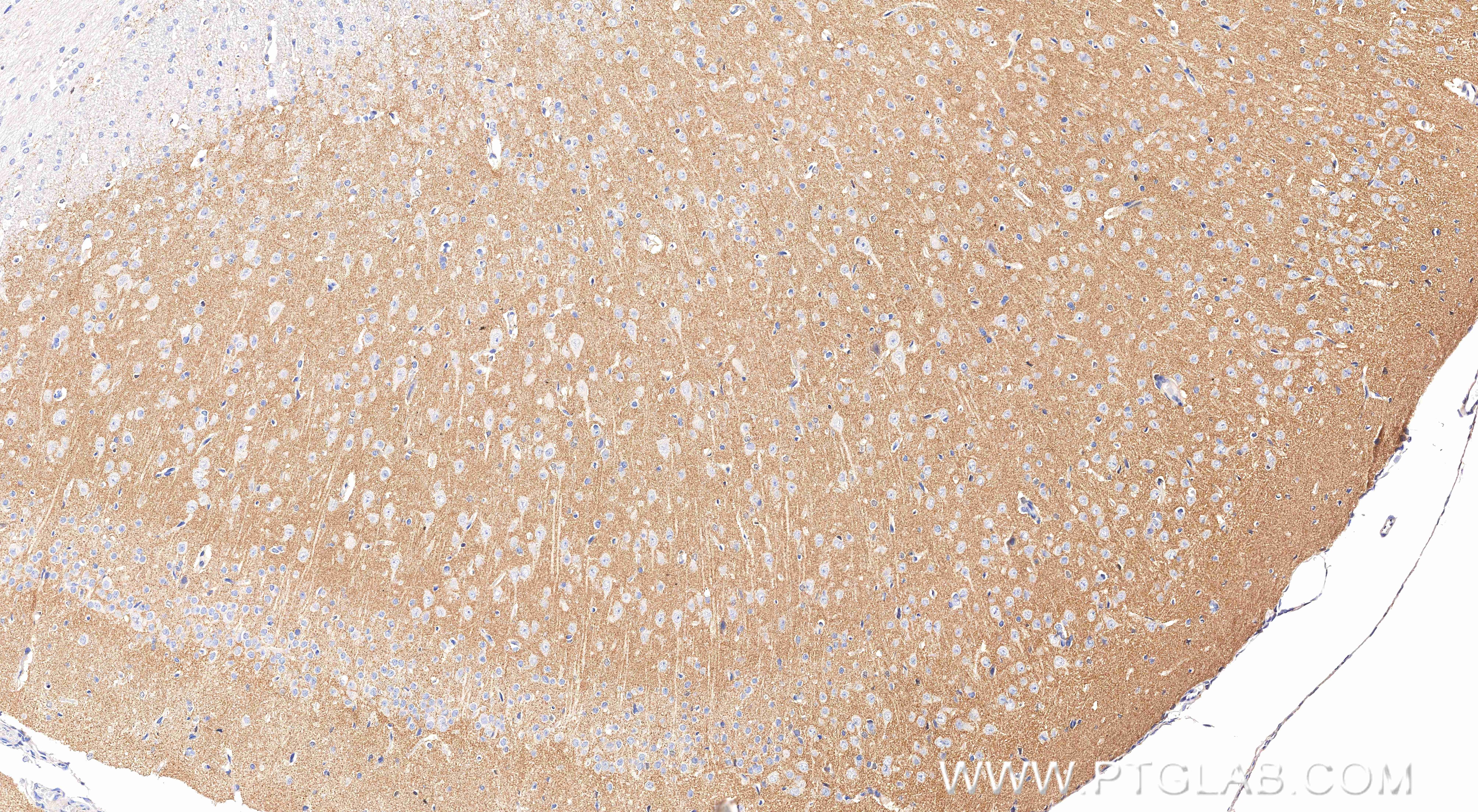 Immunohistochemistry (IHC) staining of rat brain tissue using SCN11A Recombinant monoclonal antibody (85740-1-RR)