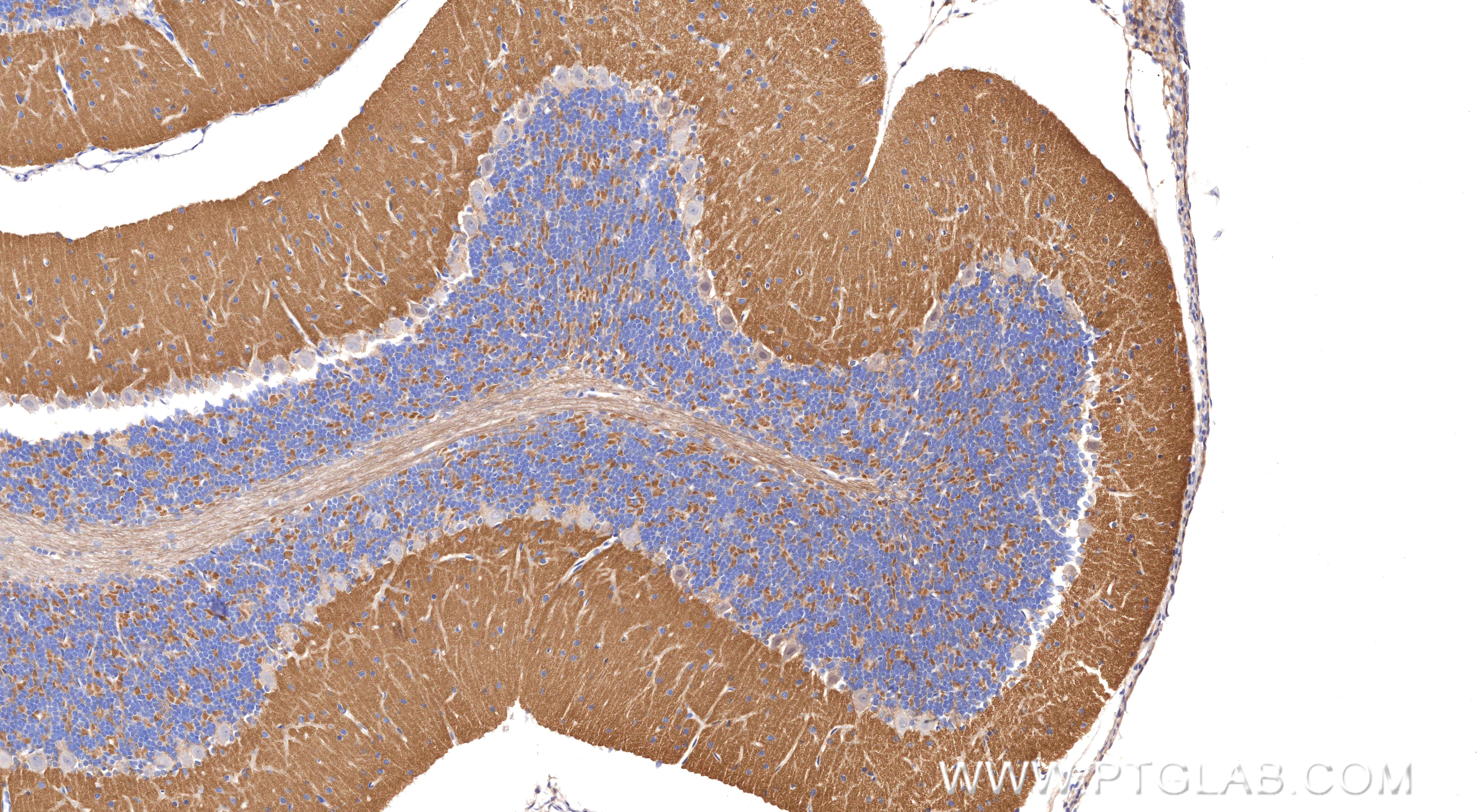Immunohistochemistry (IHC) staining of rat cerebellum tissue using SCN11A Recombinant monoclonal antibody (85740-1-RR)