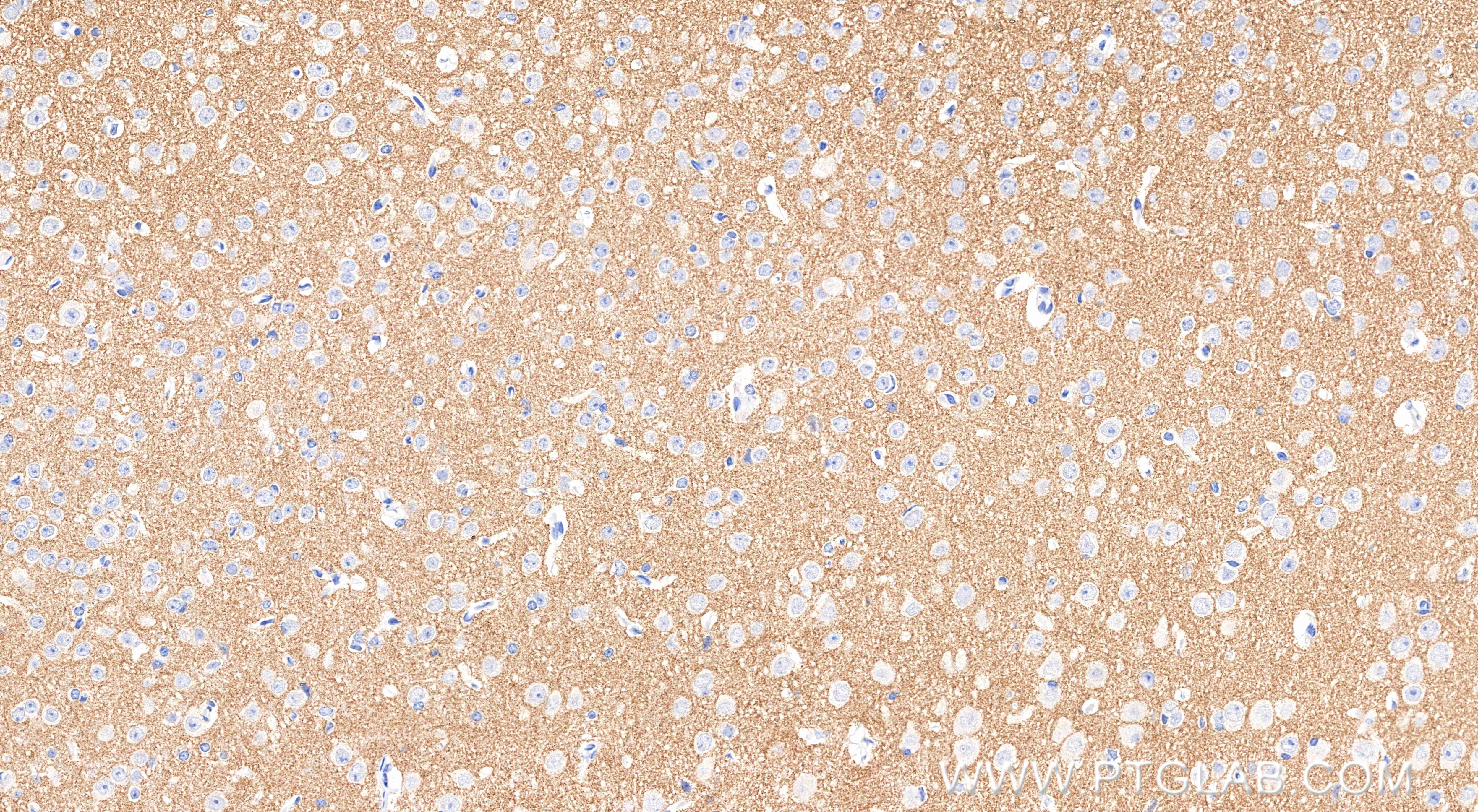 Immunohistochemistry (IHC) staining of mouse brain tissue using SCN11A Recombinant monoclonal antibody (85740-1-RR)
