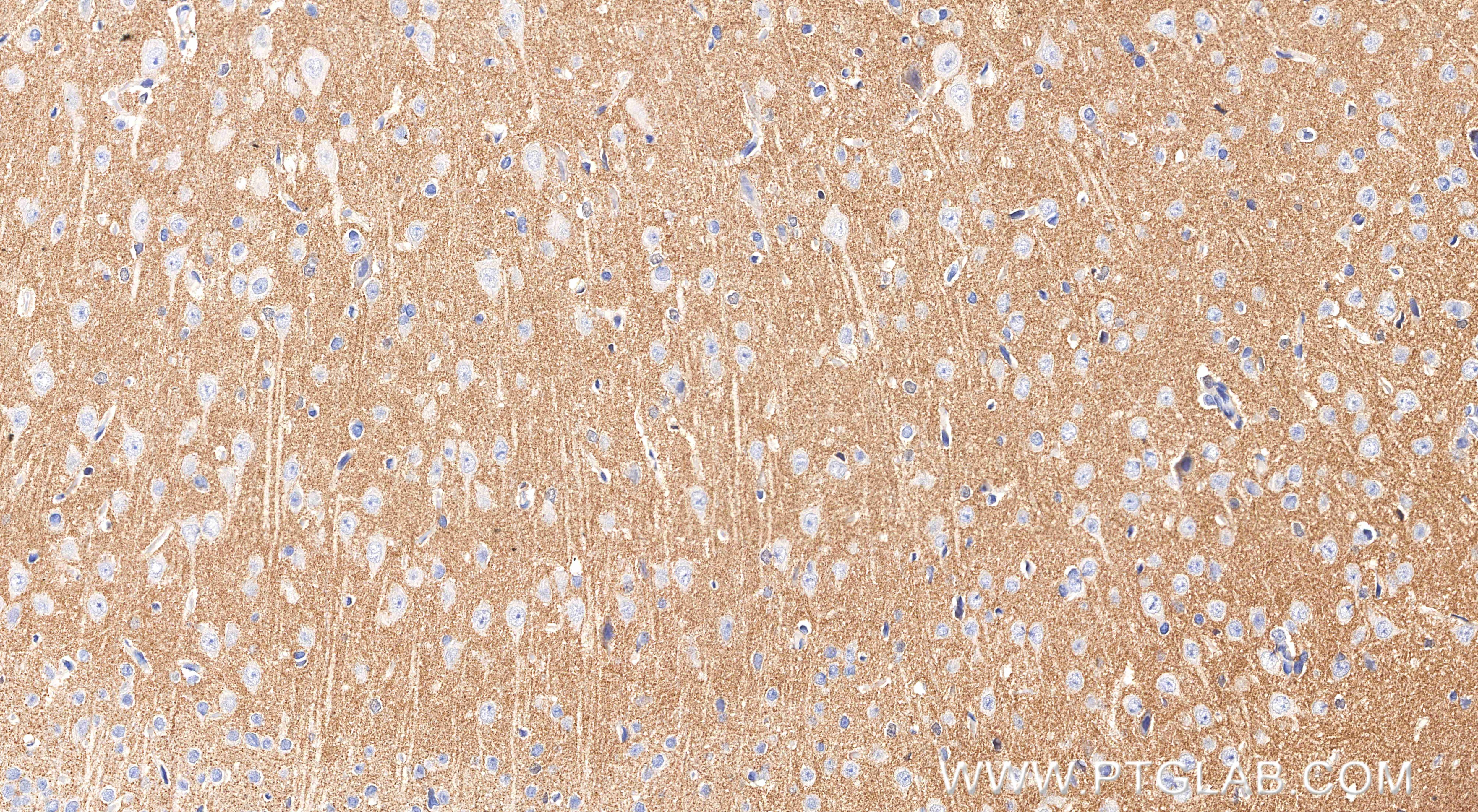 Immunohistochemistry (IHC) staining of rat brain tissue using SCN11A Recombinant monoclonal antibody (85740-1-RR)