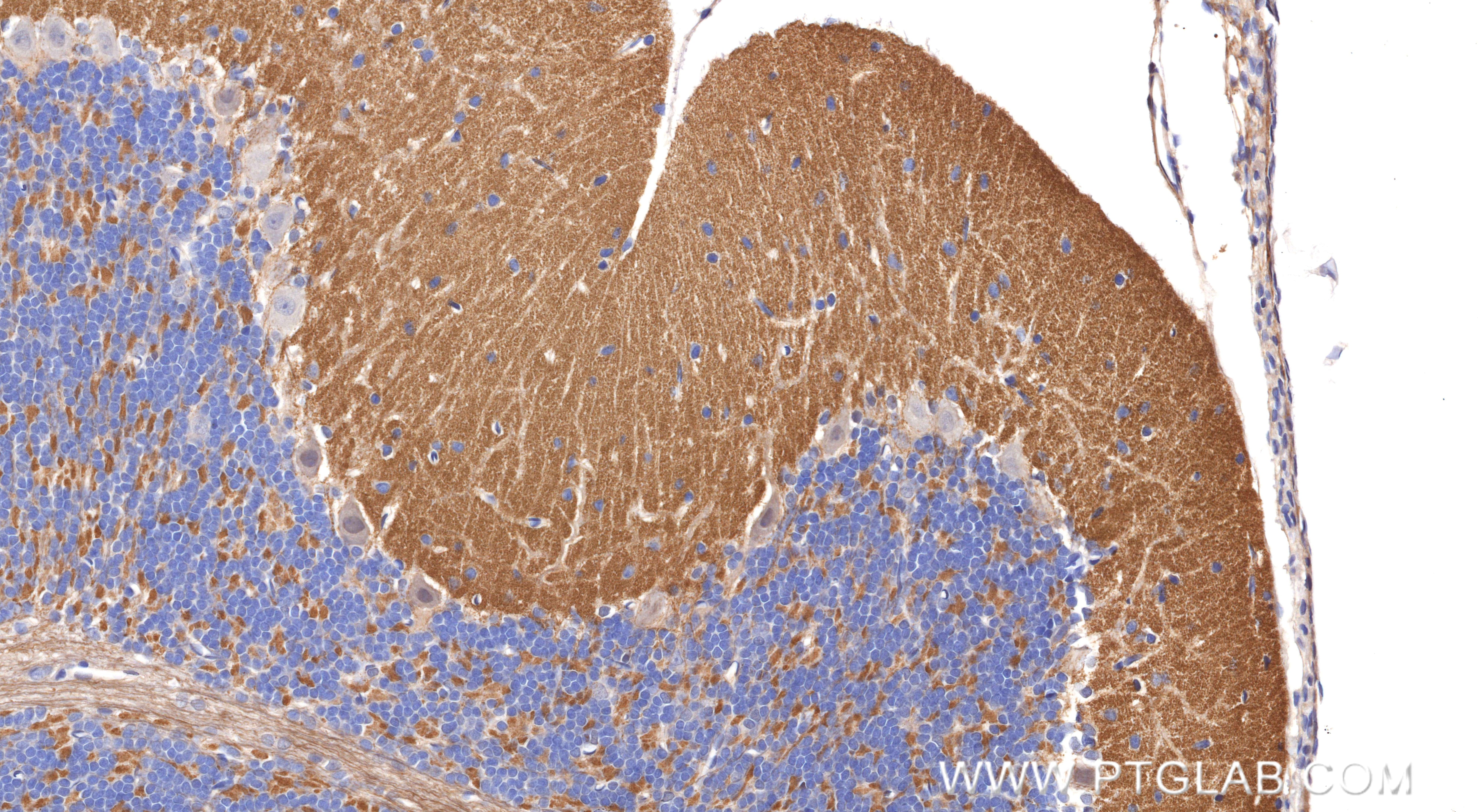 Immunohistochemistry (IHC) staining of rat cerebellum tissue using SCN11A Recombinant monoclonal antibody (85740-1-RR)