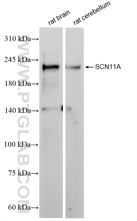 SCN11A