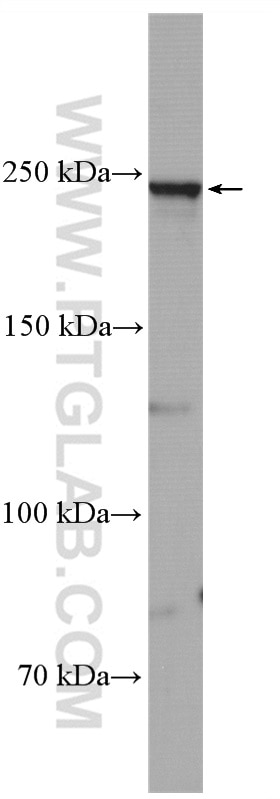 Western Blot (WB) analysis of PC-12 cells using SCN1A Polyclonal antibody (28079-1-AP)