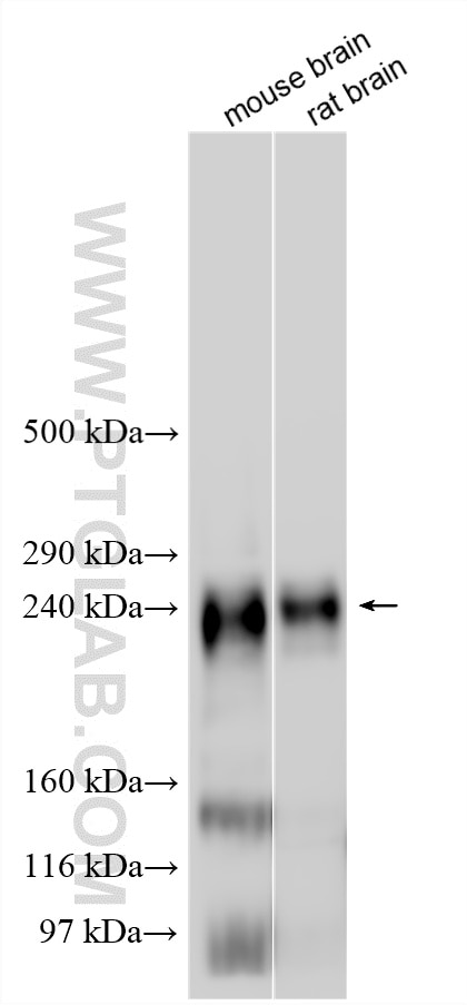 Western Blot (WB) analysis of various lysates using SCN1A Polyclonal antibody (28079-1-AP)