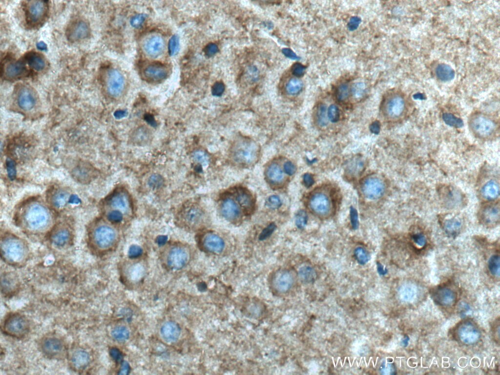 SCN1B
