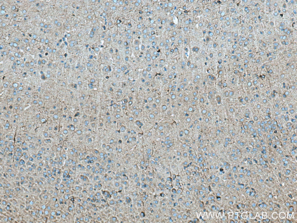 IHC staining of mouse brain using 11484-1-AP