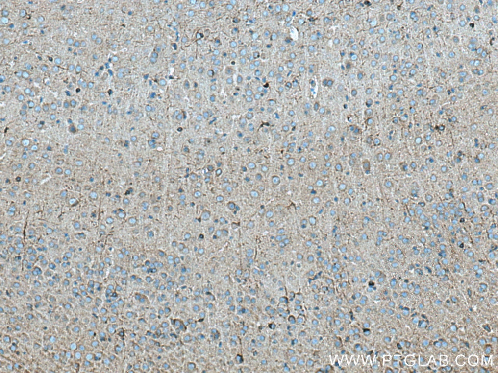 Immunohistochemistry (IHC) staining of mouse brain tissue using SCN1B Polyclonal antibody (11484-1-AP)