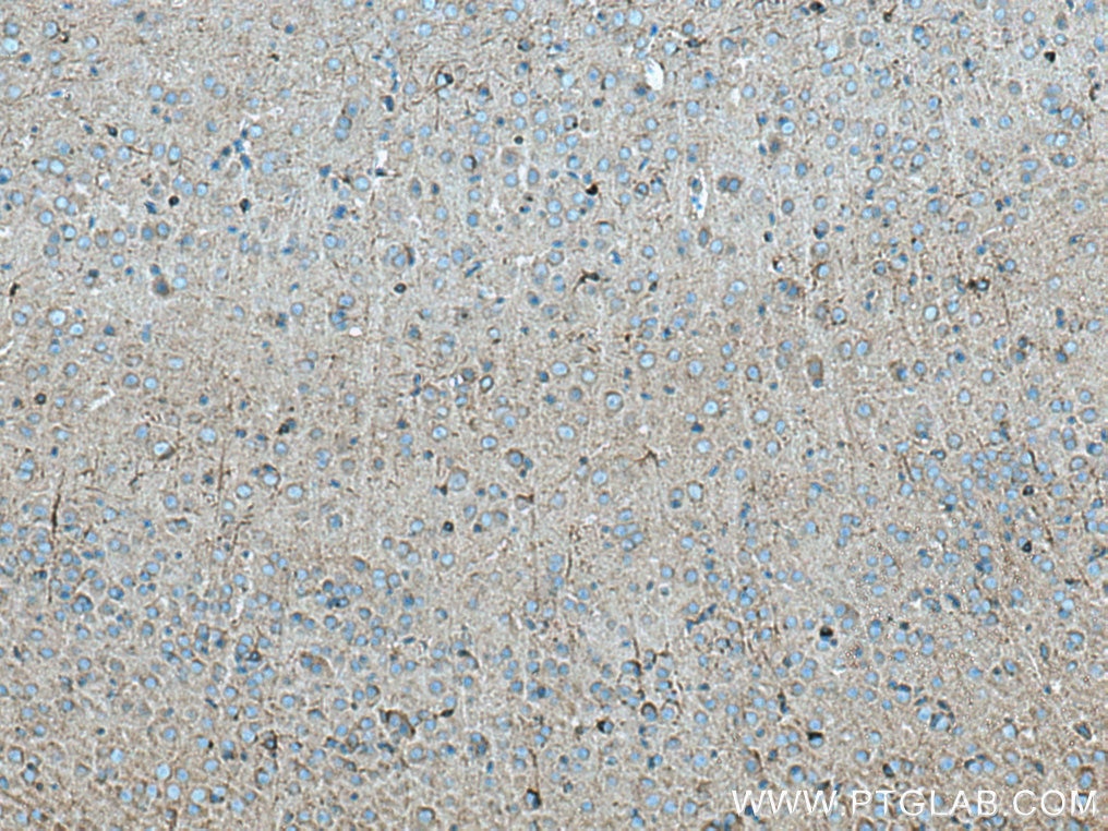 Immunohistochemistry (IHC) staining of mouse brain tissue using SCN1B Polyclonal antibody (11484-1-AP)