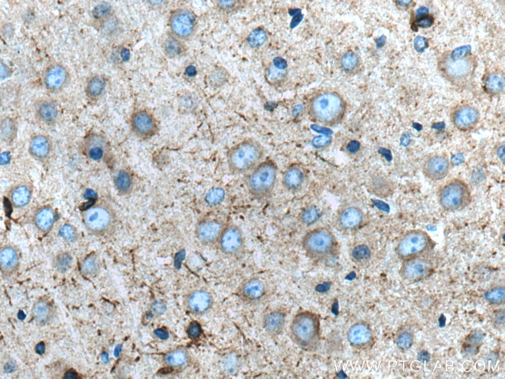 Immunohistochemistry (IHC) staining of mouse brain tissue using SCN1B Polyclonal antibody (11484-1-AP)