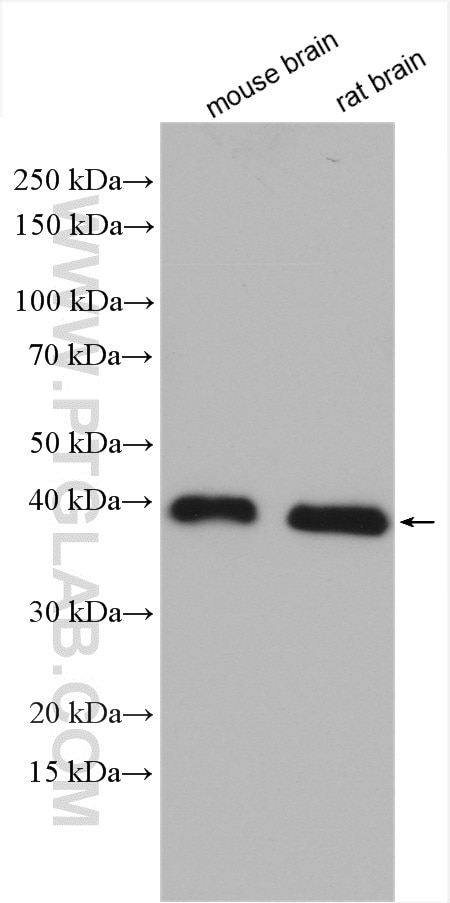 Western Blot (WB) analysis of various lysates using SCN1B Polyclonal antibody (11484-1-AP)