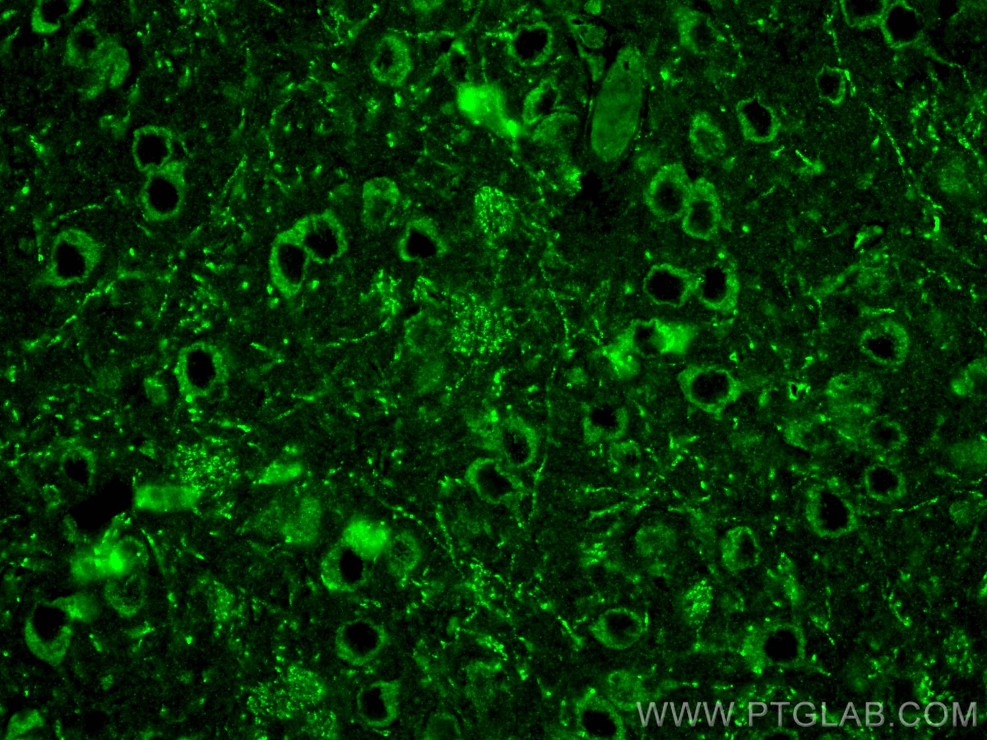 Immunofluorescence (IF) / fluorescent staining of mouse brain tissue using SCN2A Polyclonal antibody (27551-1-AP)