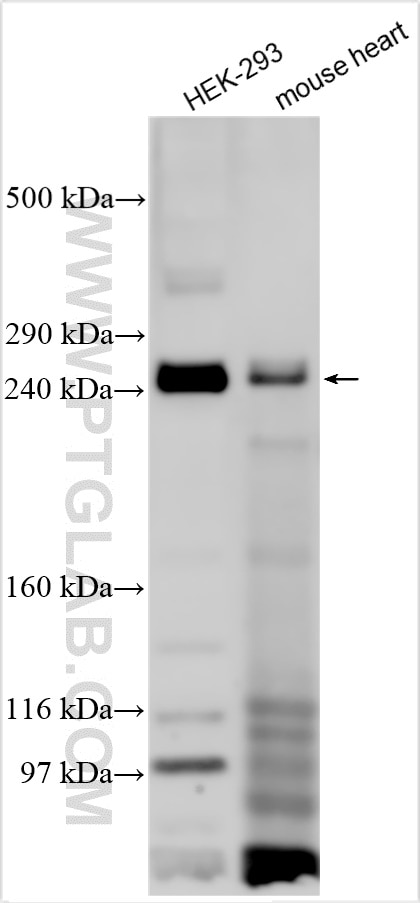 Western Blot (WB) analysis of various lysates using SCN2A Polyclonal antibody (27551-1-AP)