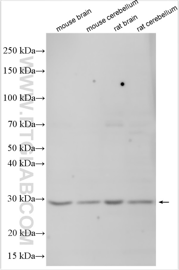 Western Blot (WB) analysis of various lysates using SCN2B Polyclonal antibody (13612-1-AP)