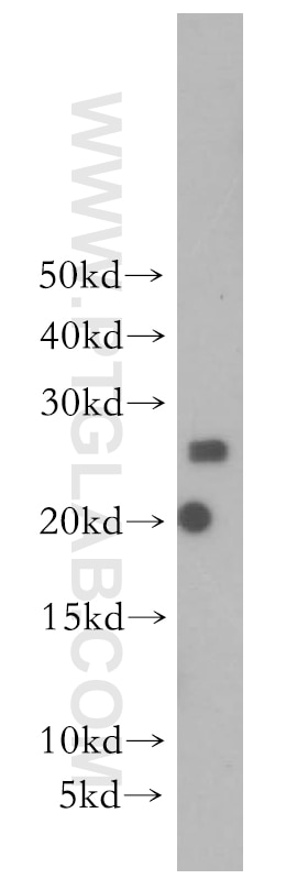 Western Blot (WB) analysis of human brain tissue using SCN2B Polyclonal antibody (13612-1-AP)