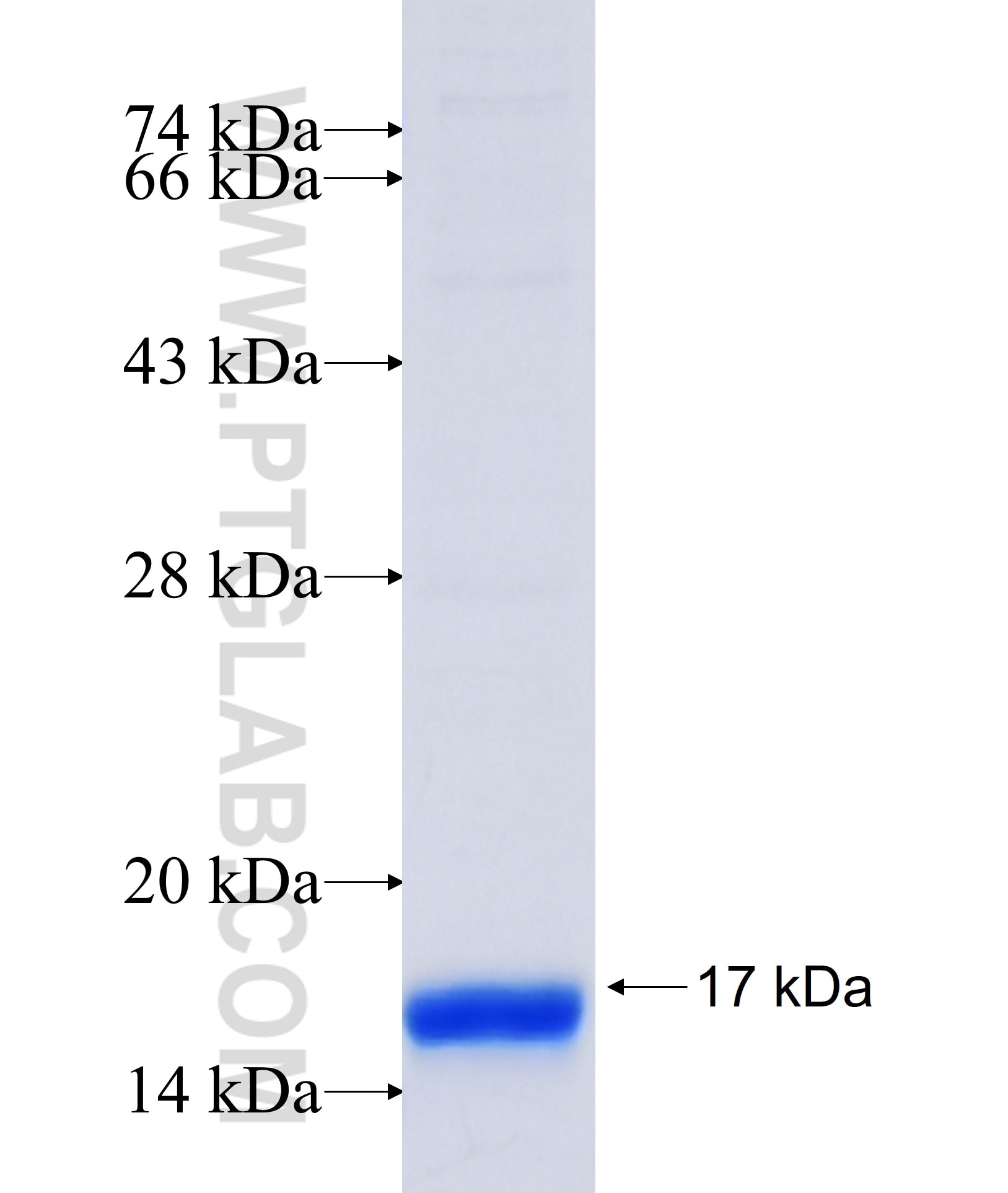 SCN3A fusion protein Ag35472 SDS-PAGE SCN3A fusion protein Ag35472 SDS-PAGE