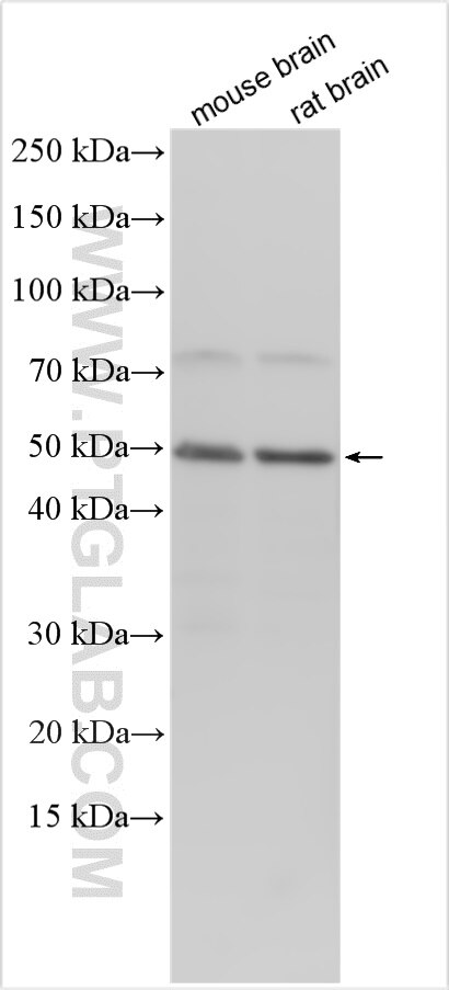 Western Blot (WB) analysis of various lysates using SCN3B Polyclonal antibody (25907-1-AP)