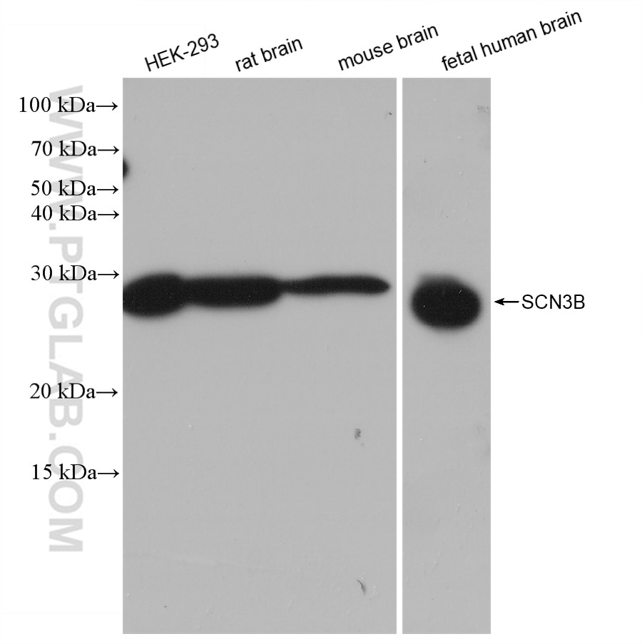 Western Blot (WB) analysis of various lysates using SCN3B Recombinant antibody (82959-1-RR)