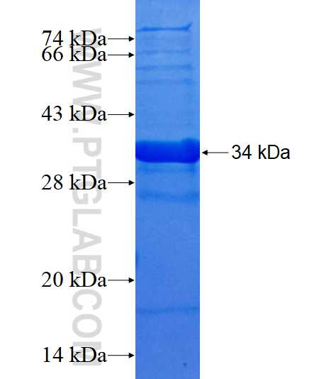SCN3B fusion protein Ag23201 SDS-PAGE