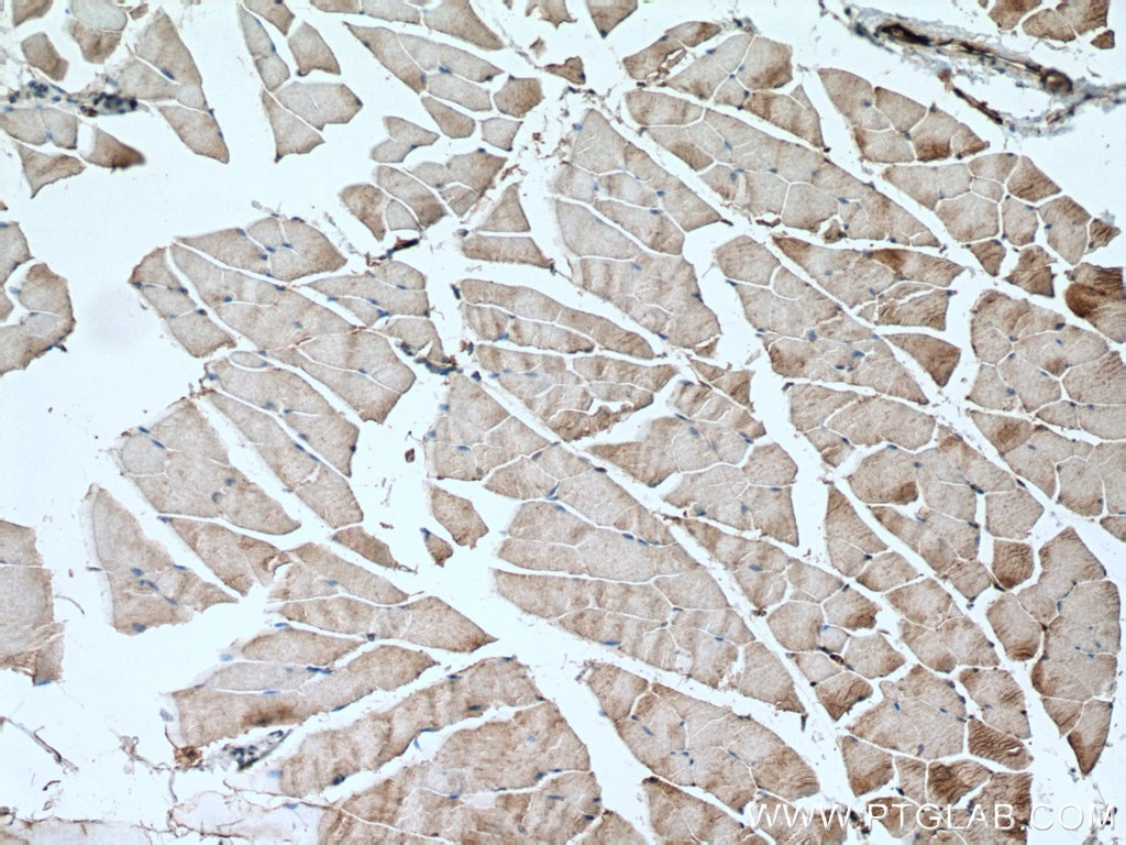 Immunohistochemistry (IHC) staining of mouse skeletal muscle tissue using SCN4A Polyclonal antibody (28315-1-AP)