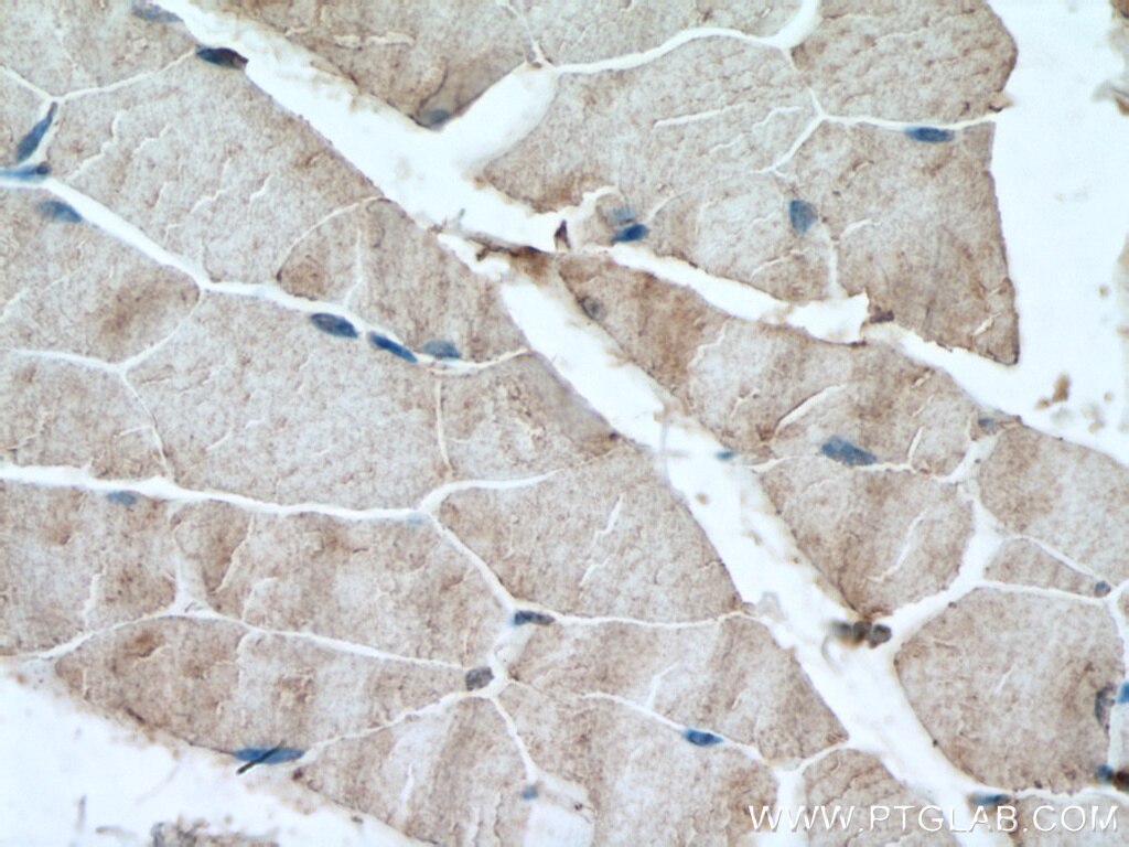 Immunohistochemistry (IHC) staining of mouse skeletal muscle tissue using SCN4A Polyclonal antibody (28315-1-AP)