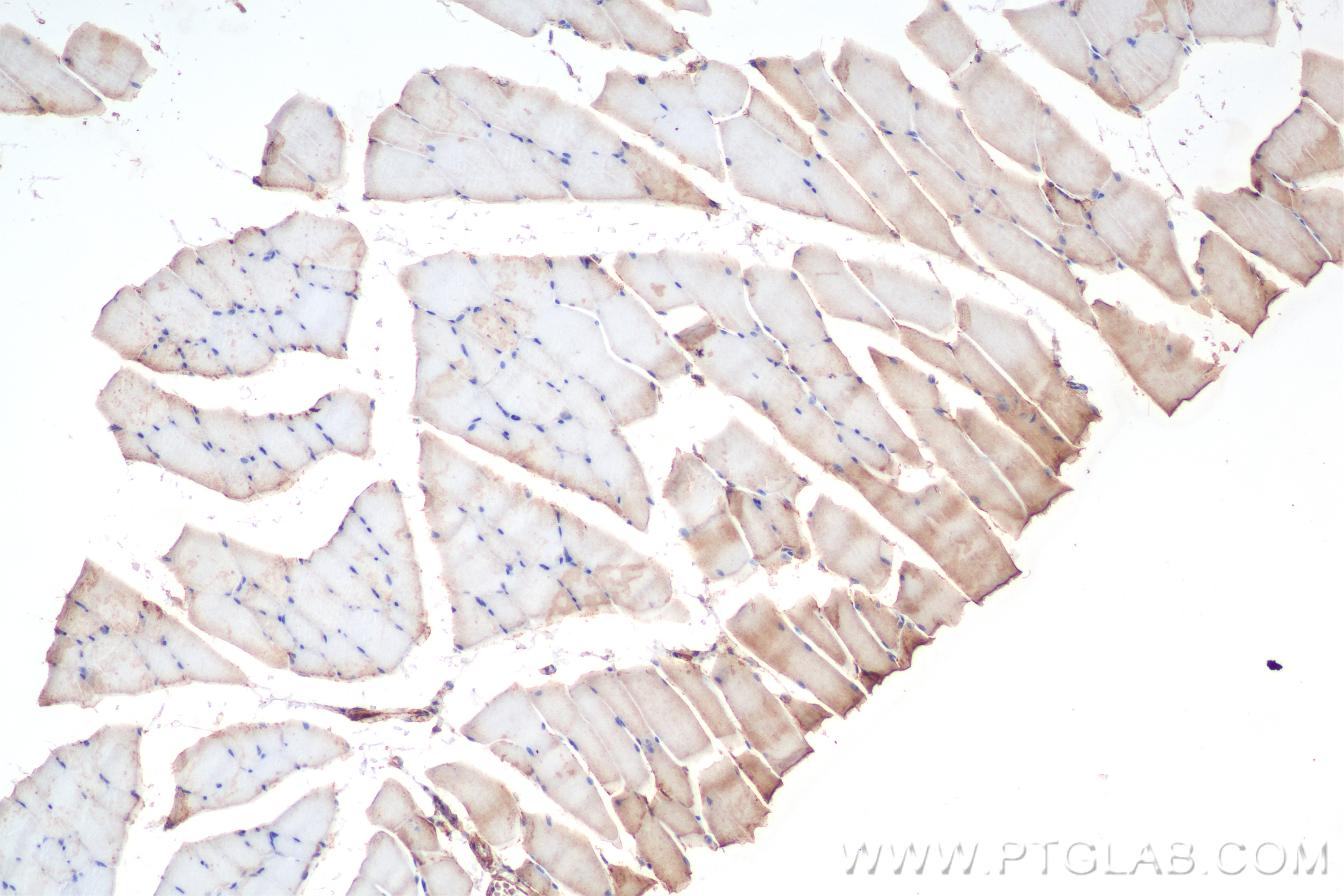 Immunohistochemistry (IHC) staining of mouse skeletal muscle tissue using SCN4A Recombinant antibody (85698-1-RR)