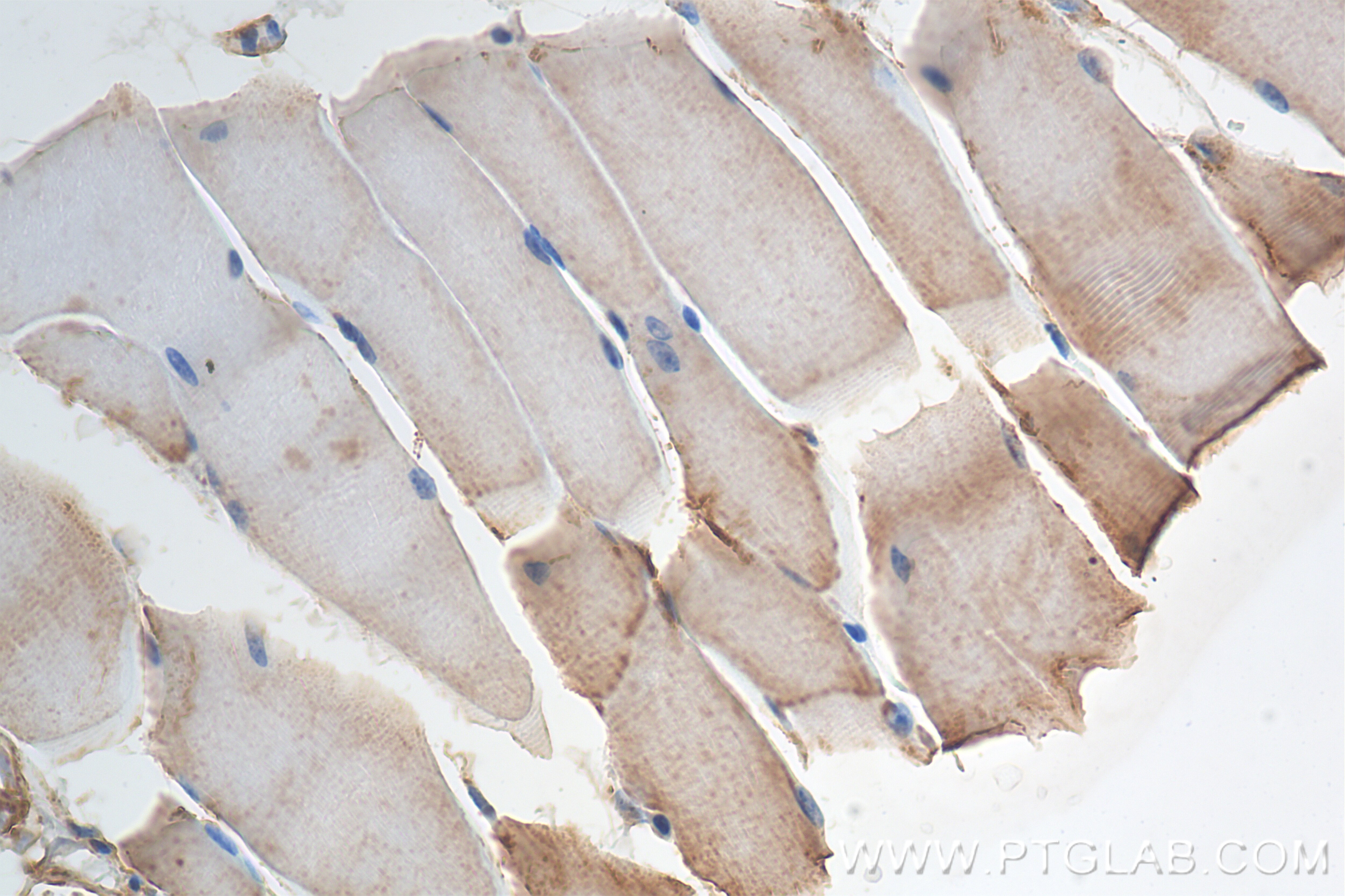 Immunohistochemistry (IHC) staining of mouse skeletal muscle tissue using SCN4A Recombinant antibody (85698-1-RR)