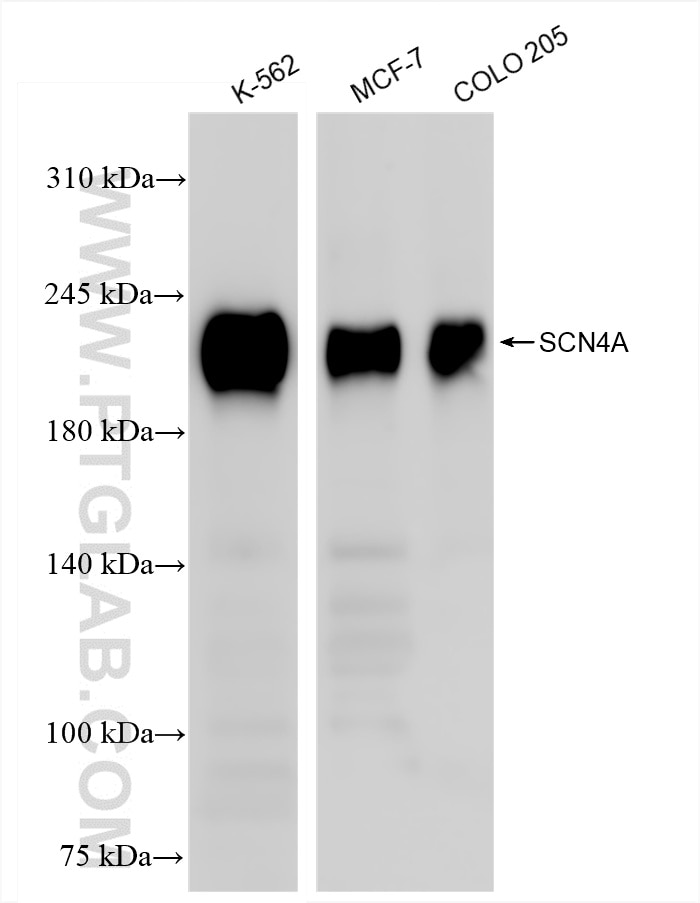 Western Blot (WB) analysis of various lysates using SCN4A Recombinant antibody (85698-1-RR)