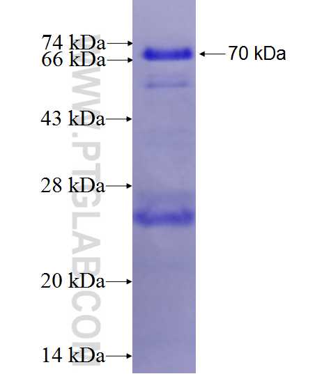 SCN4A fusion protein Ag27536 SDS-PAGE