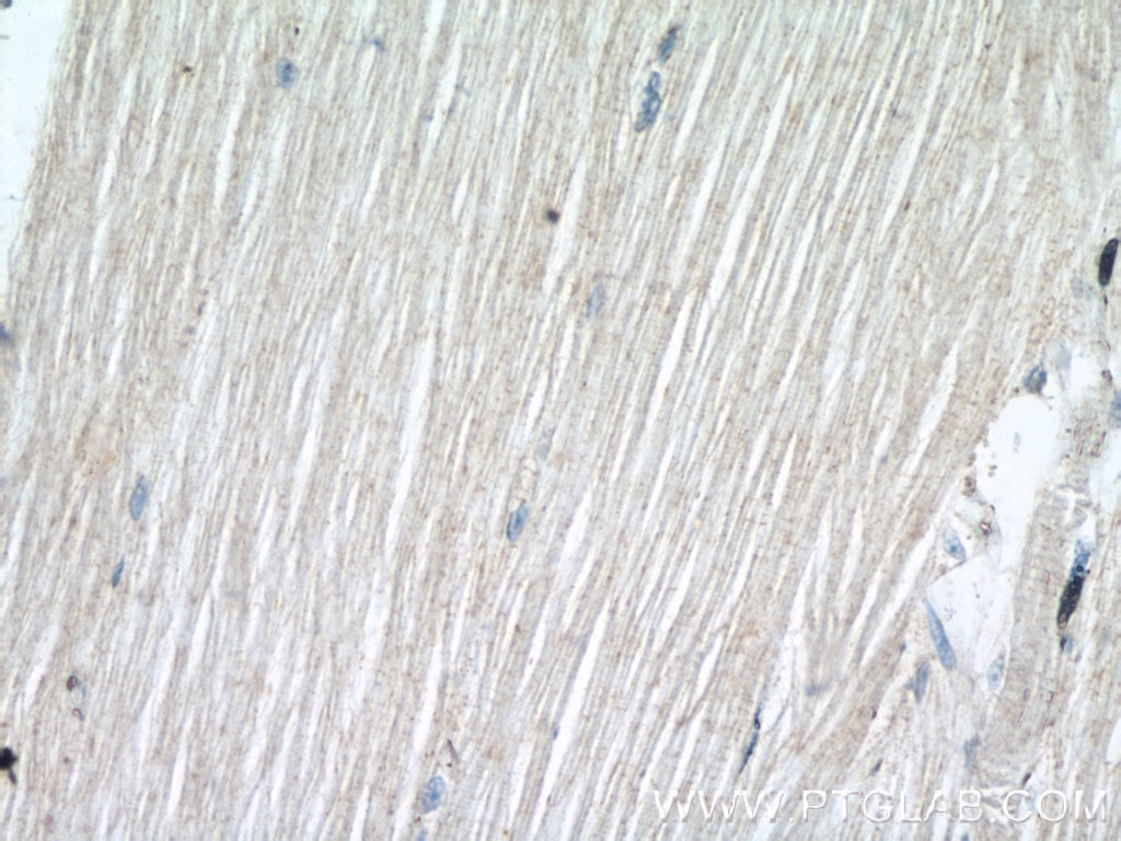 Immunohistochemistry (IHC) staining of human skeletal muscle tissue using SCN4B Polyclonal antibody (55438-1-AP)