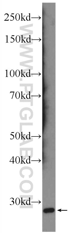 Western Blot (WB) analysis of mouse brain tissue using SCN4B Polyclonal antibody (55438-1-AP)