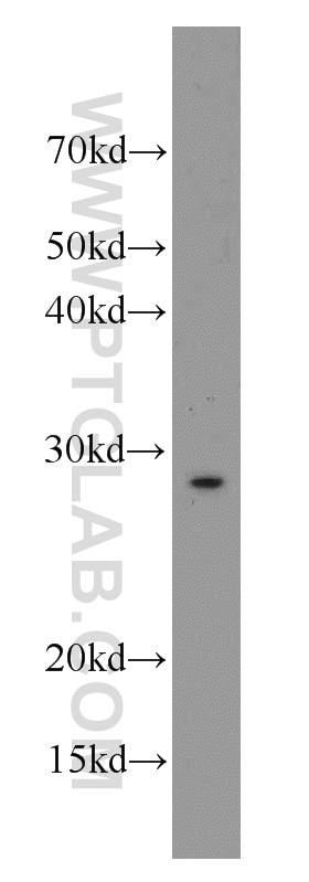 Western Blot (WB) analysis of mouse heart tissue using SCN4B Polyclonal antibody (55438-1-AP)