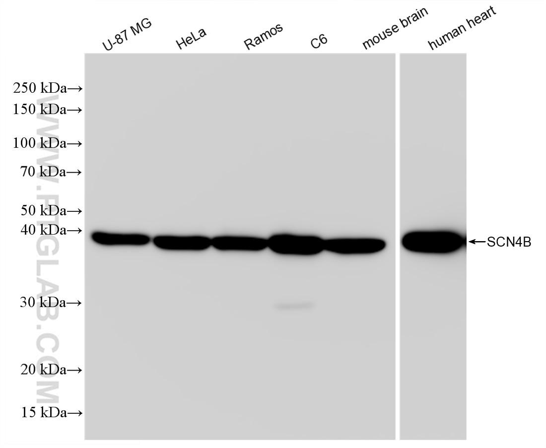 Western Blot (WB) analysis of various lysates using SCN4B Recombinant antibody (83027-4-RR)